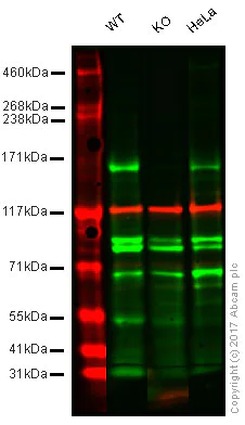 Western blot - Anti-KDM5B / PLU1 / Jarid1B antibody [EPR12704] - BSA and Azide free (AB232590)