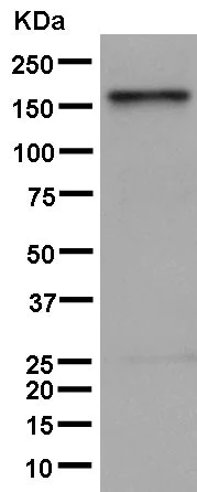 Western blot - Anti-KDM5B / PLU1 / Jarid1B antibody [EPR12704] - BSA and Azide free (AB232590)