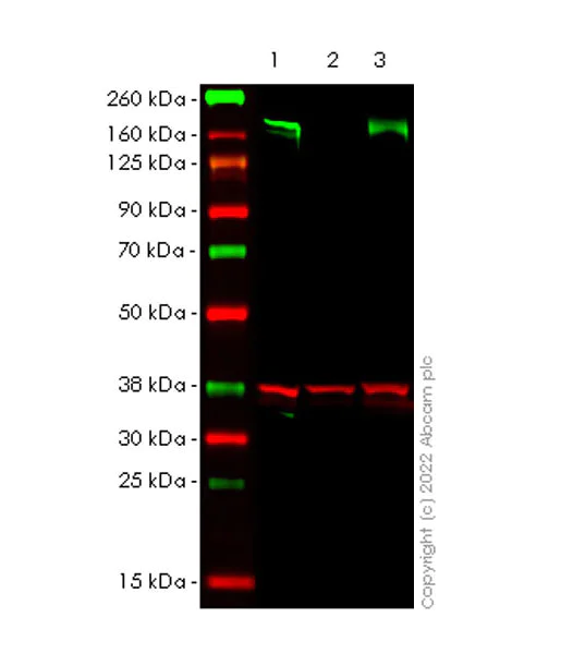 Western blot - Anti-KDM5B / PLU1 / Jarid1B antibody [EPR25242-12] (BSA and Azide free) (AB306580)