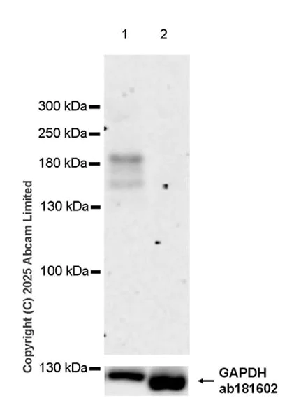 Western blot - Anti-KDM5B / PLU1 / Jarid1B antibody [EPR30394-502] - BSA and Azide free (AB325403)