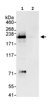 Immunoprecipitation - Anti-KDM5C / Jarid1C / SMCX antibody (AB264168), expandable thumbnail