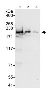 Western blot - Anti-KDM5C / Jarid1C / SMCX antibody (AB264168), expandable thumbnail