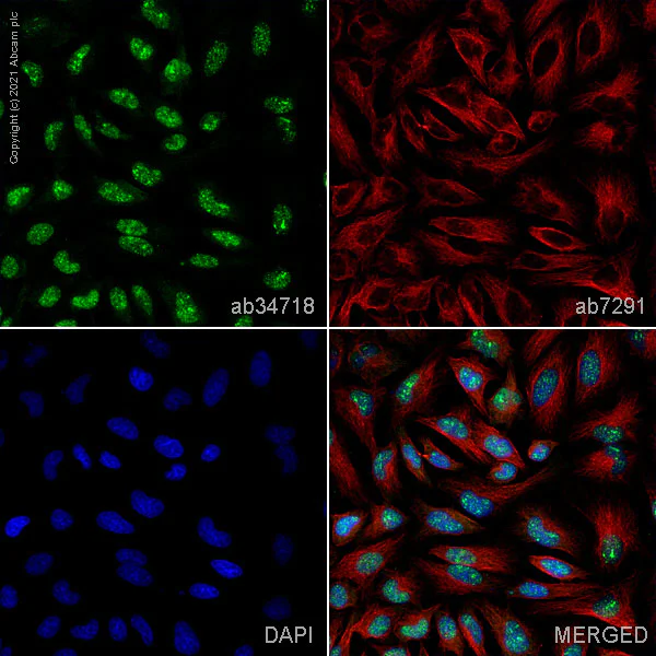 Immunocytochemistry/ Immunofluorescence - Anti-KDM5C / Jarid1C / SMCX antibody (AB34718)