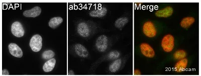 Immunocytochemistry/ Immunofluorescence - Anti-KDM5C / Jarid1C / SMCX antibody (AB34718)
