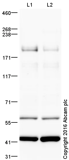 Western blot - Anti-KDM5C / Jarid1C / SMCX antibody (AB34718)