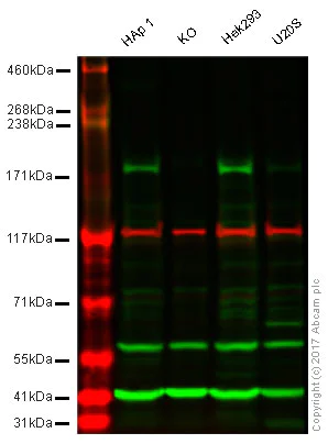 Western blot - Anti-KDM5C / Jarid1C / SMCX antibody (AB34718)