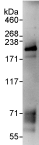 Immunoprecipitation - Anti-KDM5C / Jarid1C / SMCX antibody (AB72152)