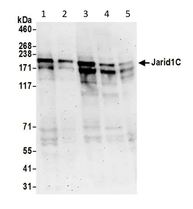 Western blot - Anti-KDM5C / Jarid1C / SMCX antibody (AB72152)