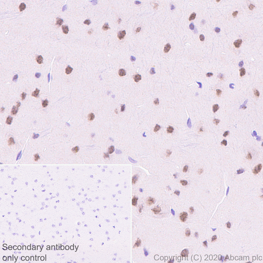Immunohistochemistry (Formalin/PFA-fixed paraffin-embedded sections) - Anti-KDM5C / Jarid1C / SMCX + KDM5D / Jarid1D / SMCY antibody [EPR18653] - BSA and Azide free (ab232318), expandable thumbnail