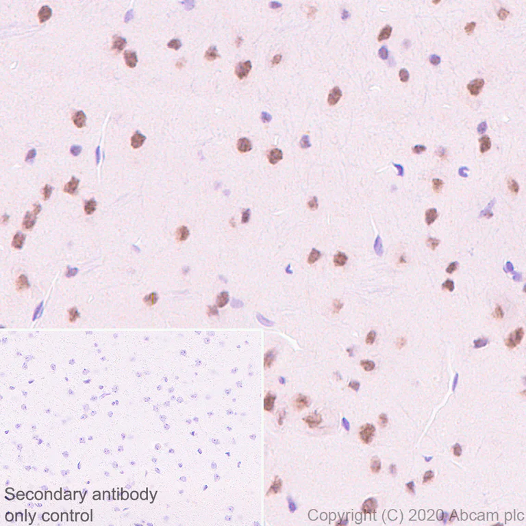 Immunohistochemistry (Formalin/PFA-fixed paraffin-embedded sections) - Anti-KDM5C / Jarid1C / SMCX + KDM5D / Jarid1D / SMCY antibody [EPR18653] - BSA and Azide free (AB232318)