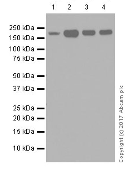 Western blot - Anti-KDM5C / Jarid1C / SMCX + KDM5D / Jarid1D / SMCY antibody [EPR18653] - BSA and Azide free (AB232318), expandable thumbnail