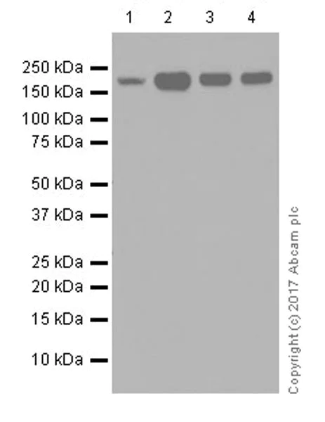 Western blot - Anti-KDM5C / Jarid1C / SMCX + KDM5D / Jarid1D / SMCY antibody [EPR18653] - BSA and Azide free (AB232318)