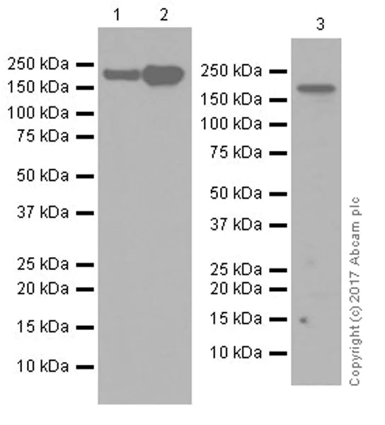 Western blot - Anti-KDM5C / Jarid1C / SMCX + KDM5D / Jarid1D / SMCY antibody [EPR18653] - ChIP Grade (AB194288)