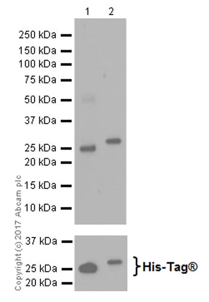 Western blot - Anti-KDM5C / Jarid1C / SMCX + KDM5D / Jarid1D / SMCY antibody [EPR18653] - ChIP Grade (AB194288)