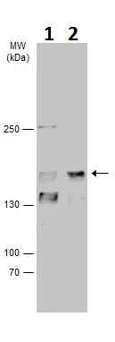 Western blot - Anti-KDM5D / Jarid1D / SMCY antibody - C-terminal (AB227728)
