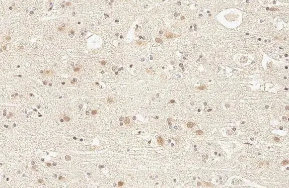 Immunohistochemistry (Formalin/PFA-fixed paraffin-embedded sections) - Anti-KDM6A antibody [HL1731] (AB308193)