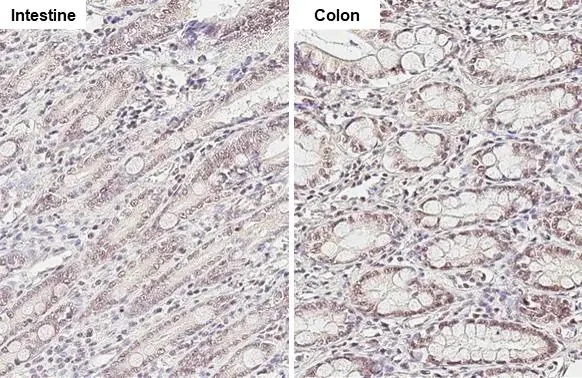 Immunohistochemistry (Formalin/PFA-fixed paraffin-embedded sections) - Anti-KDM6A antibody [HL1731] (AB308193)