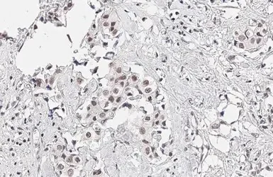 Immunohistochemistry paraffin embedded sections - Anti-KDM6A antibody [HL1731] (AB308193)