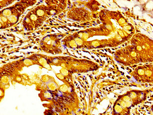 Immunohistochemistry (Formalin/PFA-fixed paraffin-embedded sections) - Anti-KDM6A / UTX antibody (AB235989)