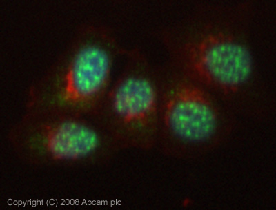 Immunocytochemistry/ Immunofluorescence - Anti-KDM6A / UTX antibody (AB36938)