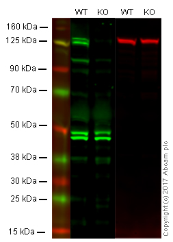 Western blot - Anti-KDM6A / UTX antibody (AB36938)