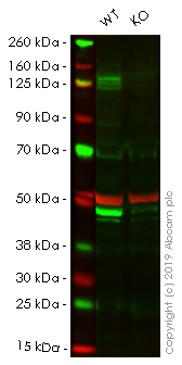 Western blot - Anti-KDM6A / UTX antibody (AB36938)