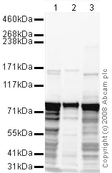 Western blot - Anti-KDM6A / UTX antibody (AB36938)