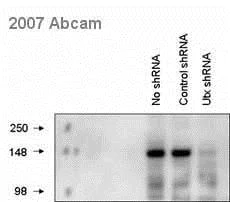 Western blot - Anti-KDM6A / UTX antibody (AB36938)