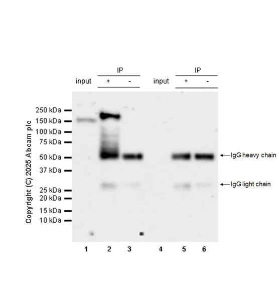 Immunoprecipitation - Anti-KDM6A / UTX antibody [EPR26387-105] (AB323566)