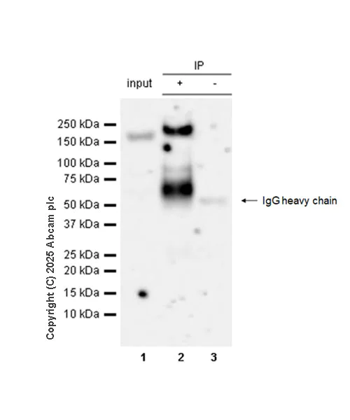 Immunoprecipitation - Anti-KDM6A / UTX antibody [EPR26387-105] (AB323566)