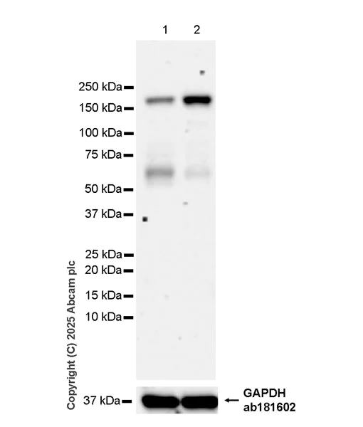 Western blot - Anti-KDM6A / UTX antibody [EPR26387-105] (AB323566)