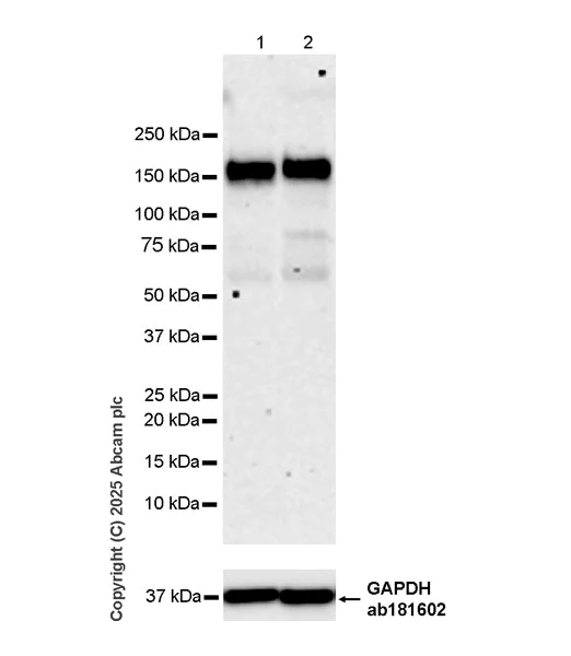 Western blot - Anti-KDM6A / UTX antibody [EPR26387-105] (AB323566)