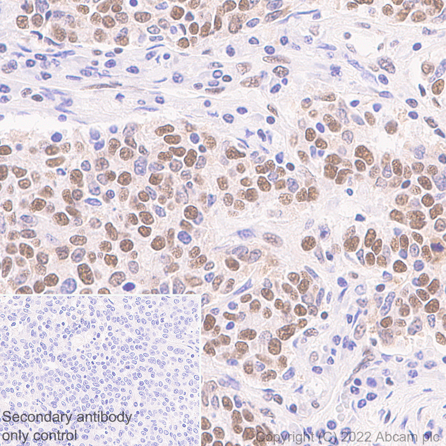 Immunohistochemistry (Formalin/PFA-fixed paraffin-embedded sections) - Anti-KDM6A / UTX antibody [EPR26387-23] (ab300513), expandable thumbnail