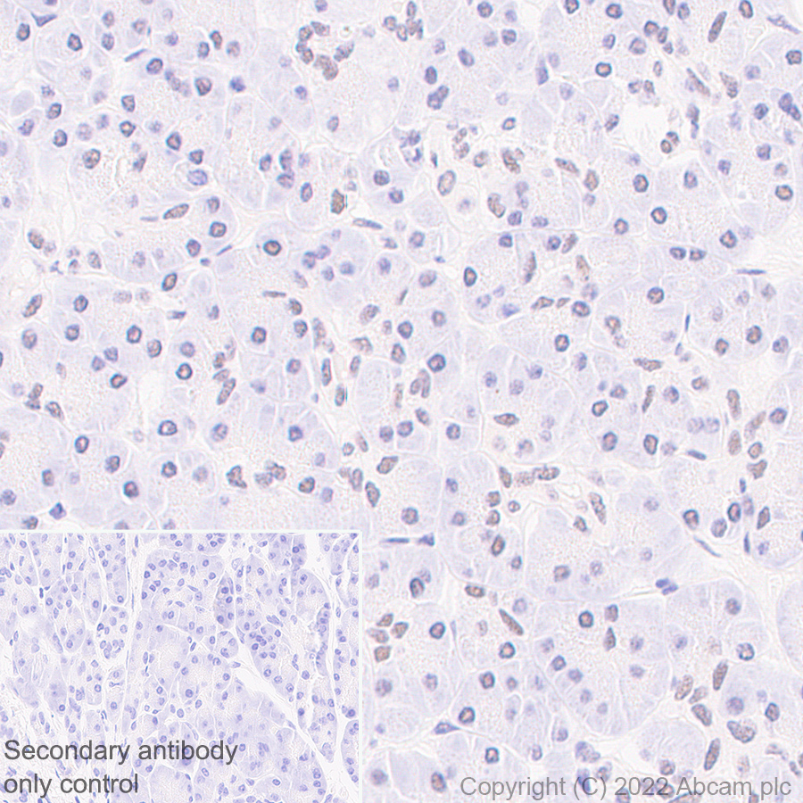 Immunohistochemistry (Formalin/PFA-fixed paraffin-embedded sections) - Anti-KDM6A / UTX antibody [EPR26387-23] (ab300513), expandable thumbnail