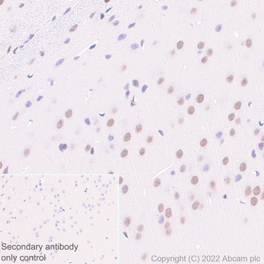 Immunohistochemistry (Formalin/PFA-fixed paraffin-embedded sections) - Anti-KDM6A / UTX antibody [EPR26387-23] (ab300513), expandable thumbnail