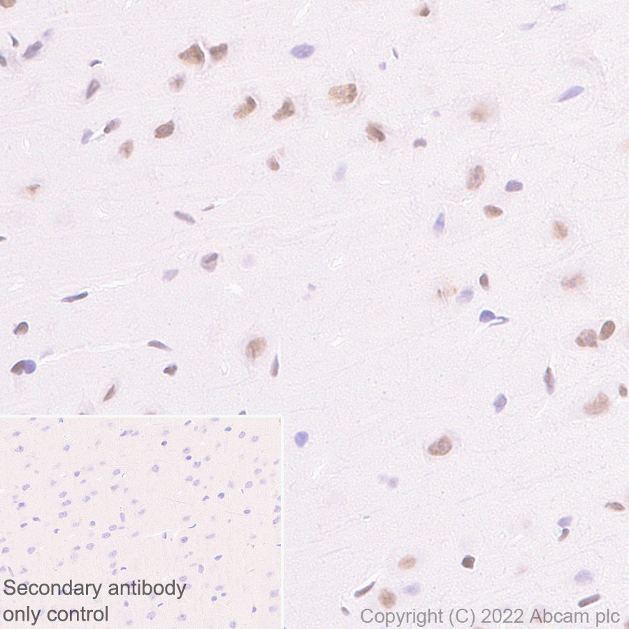 Immunohistochemistry (Formalin/PFA-fixed paraffin-embedded sections) - Anti-KDM6A / UTX antibody [EPR26387-23] (ab300513), expandable thumbnail