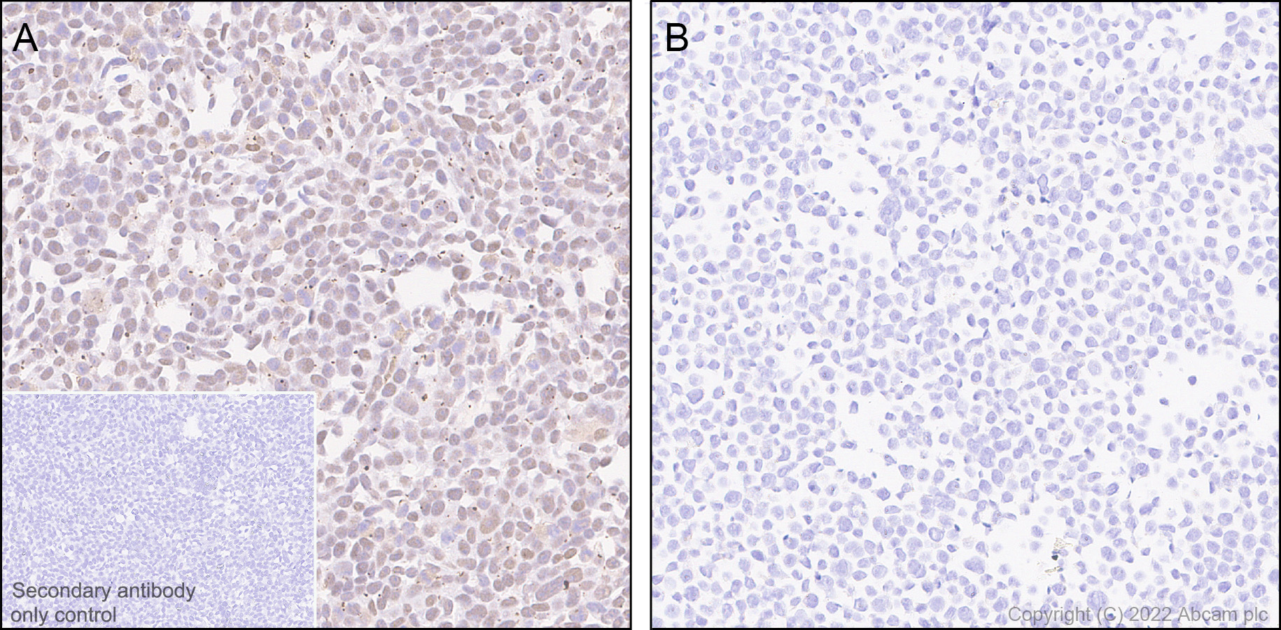 Immunohistochemistry (Formalin/PFA-fixed paraffin-embedded sections) - Anti-KDM6A / UTX antibody [EPR26387-23] (AB300513), expandable thumbnail