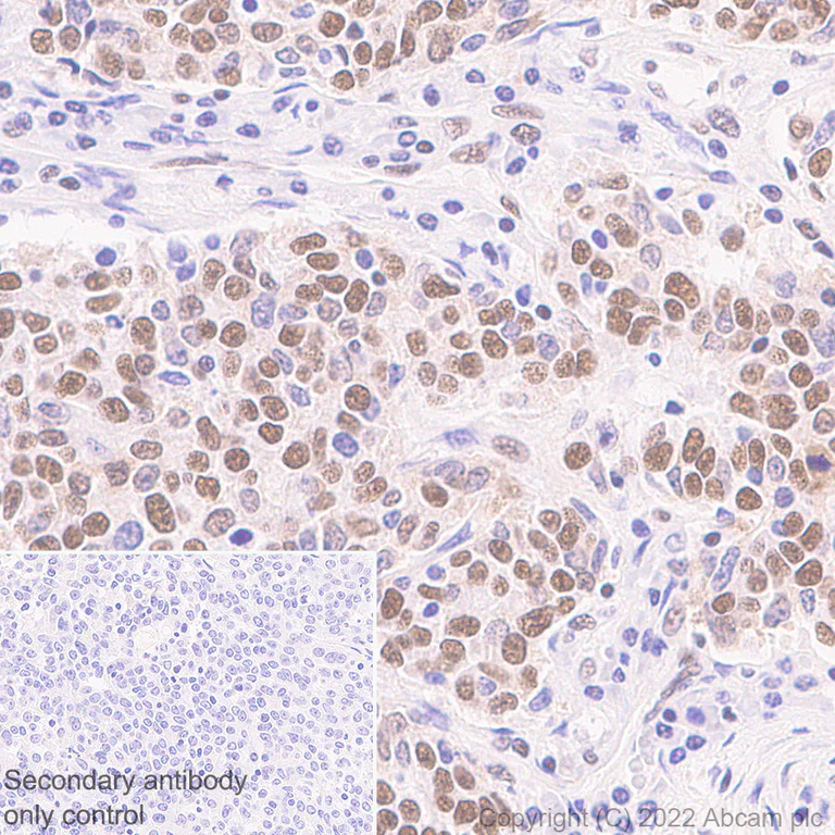 Immunohistochemistry (Formalin/PFA-fixed paraffin-embedded sections) - Anti-KDM6A / UTX antibody [EPR26387-23] (BSA and Azide free) (AB300514)