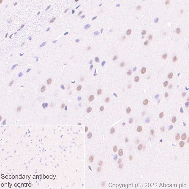 Immunohistochemistry (Formalin/PFA-fixed paraffin-embedded sections) - Anti-KDM6A / UTX antibody [EPR26387-23] (BSA and Azide free) (AB300514)