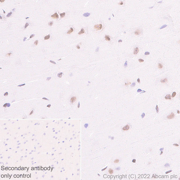 Immunohistochemistry (Formalin/PFA-fixed paraffin-embedded sections) - Anti-KDM6A / UTX antibody [EPR26387-23] (BSA and Azide free) (AB300514)