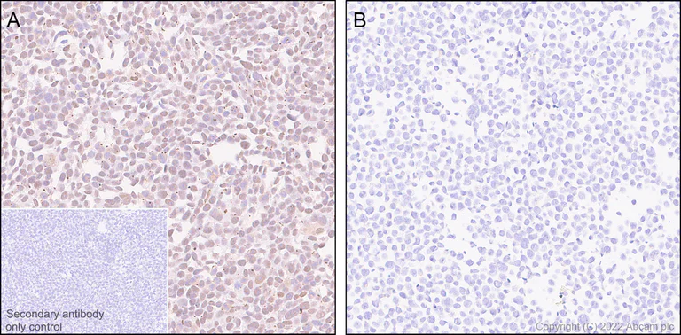 Immunohistochemistry (Formalin/PFA-fixed paraffin-embedded sections) - Anti-KDM6A / UTX antibody [EPR26387-23] (BSA and Azide free) (AB300514)