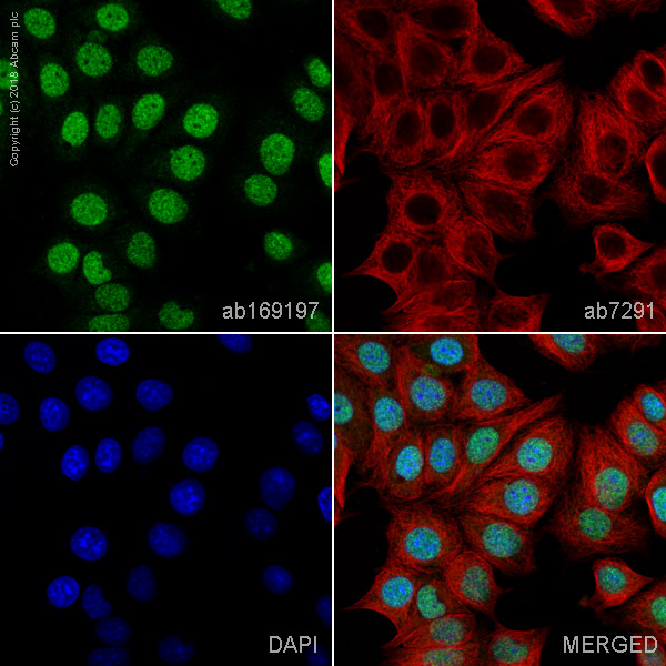 Immunocytochemistry/ Immunofluorescence - Anti-KDM6B / JMJD3 antibody (AB169197)