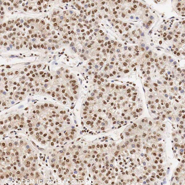 Immunohistochemistry (Formalin/PFA-fixed paraffin-embedded sections) - Anti-KDM6B / JMJD3 antibody (AB38113), expandable thumbnail