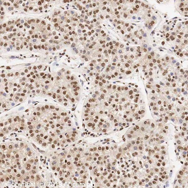 Immunohistochemistry (Formalin/PFA-fixed paraffin-embedded sections) - Anti-KDM6B / JMJD3 antibody (AB38113)