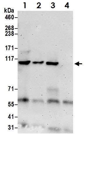 Immunoprecipitation - Anti-KDS antibody (AB70297), expandable thumbnail
