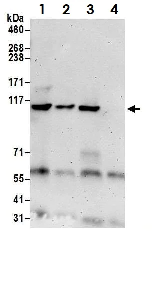 Immunoprecipitation - Anti-KDS antibody (AB70297)