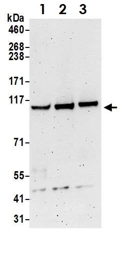 Western blot - Anti-KDS antibody (AB70297), expandable thumbnail