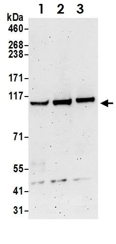 Western blot - Anti-KDS antibody (AB70297)