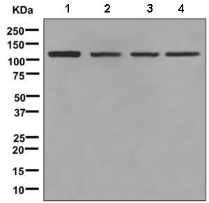 Western blot - Anti-KDS antibody [EPR4947(2)] (AB150388)