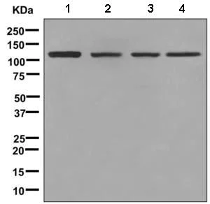 Western blot - Anti-KDS antibody [EPR4947(2)] - BSA and Azide free (AB248958)